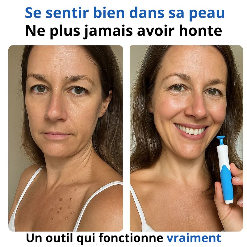 DermaPeauClair | Soins Doux