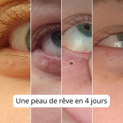 DermaPeauClair | Soins Doux